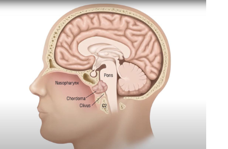 A graphic of the human skull and components within.