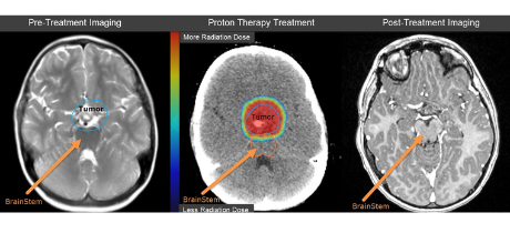 Three brain scan comparisons